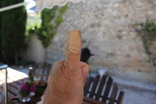 Nålen gick rakt in där den inte skulle...